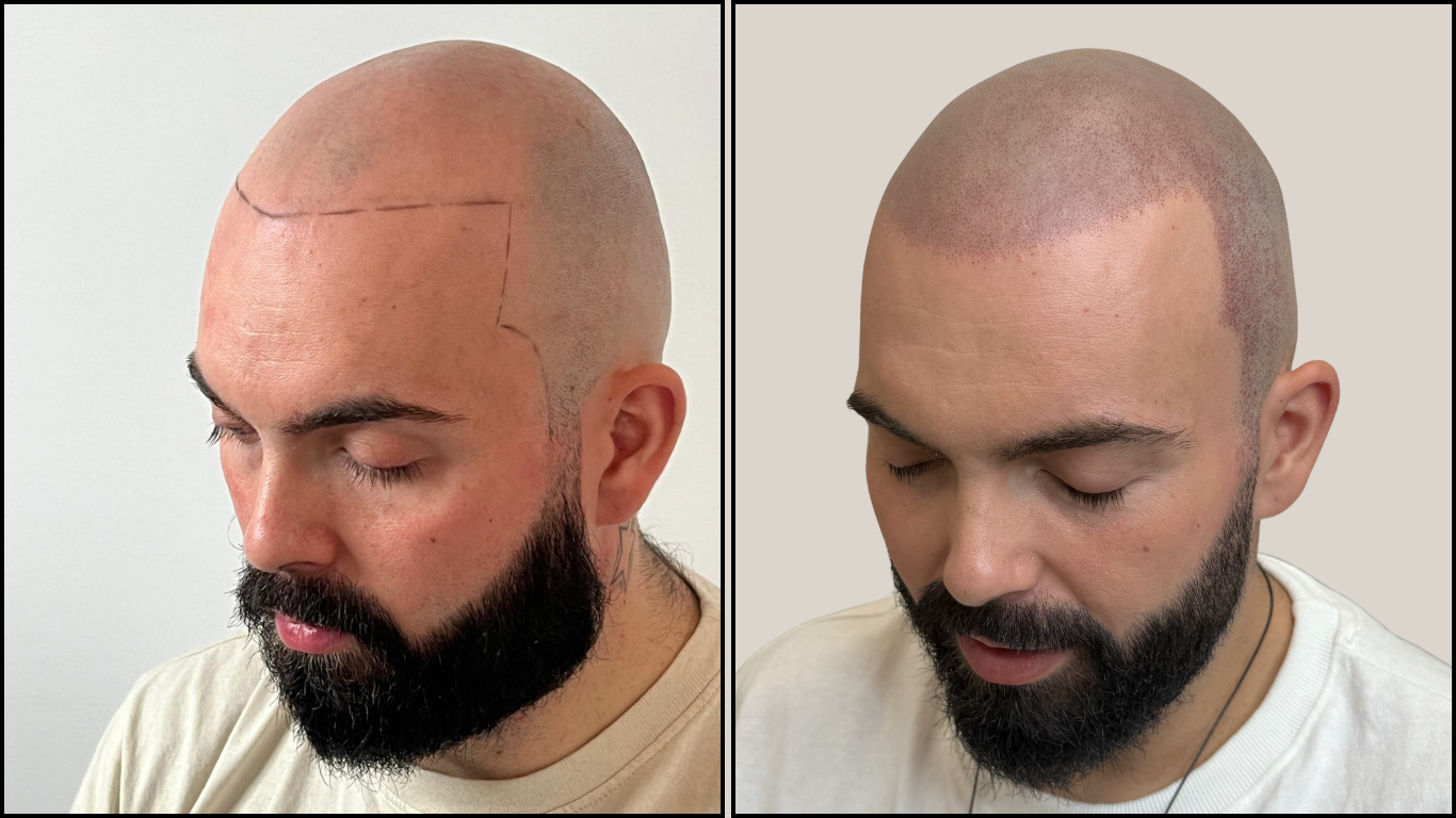 Avant / Après