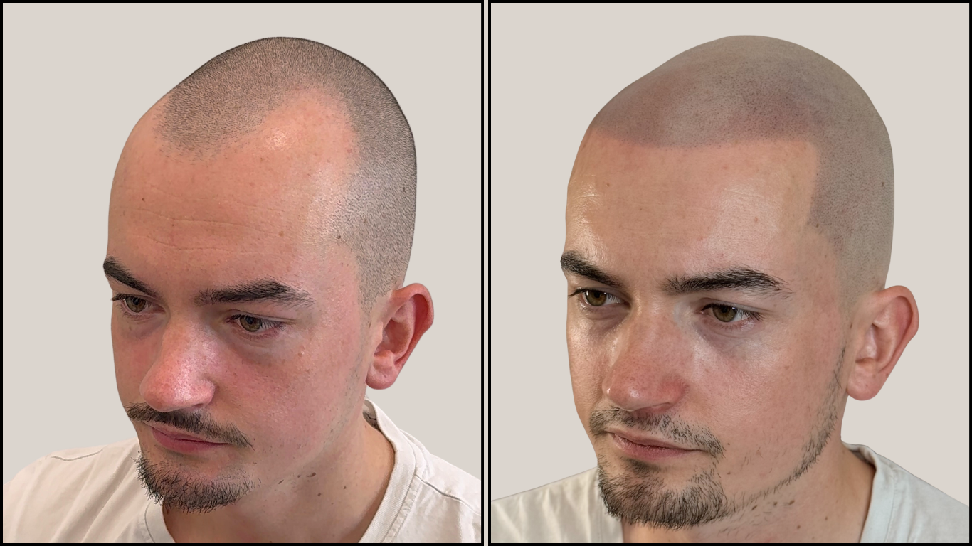 Avant / Après