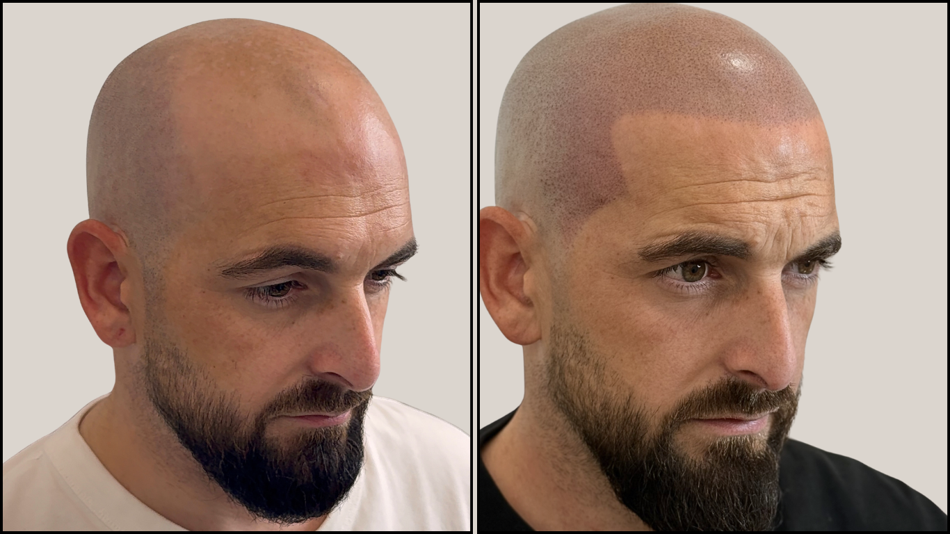 Avant / Après